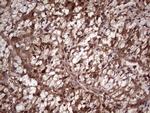 LGALS3 Antibody in Immunohistochemistry (Paraffin) (IHC (P))