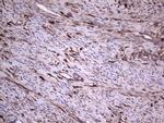 LGALS3 Antibody in Immunohistochemistry (Paraffin) (IHC (P))