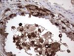 LGALS3 Antibody in Immunohistochemistry (Paraffin) (IHC (P))