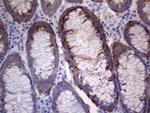 LGALS3 Antibody in Immunohistochemistry (Paraffin) (IHC (P))