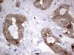 LGALS3 Antibody in Immunohistochemistry (Paraffin) (IHC (P))