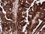 LGALS3 Antibody in Immunohistochemistry (Paraffin) (IHC (P))