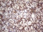 LGALS3 Antibody in Immunohistochemistry (Paraffin) (IHC (P))