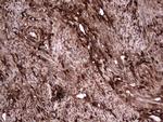 LGALS3 Antibody in Immunohistochemistry (Paraffin) (IHC (P))