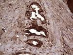 LGALS3 Antibody in Immunohistochemistry (Paraffin) (IHC (P))