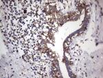 LGALS3 Antibody in Immunohistochemistry (Paraffin) (IHC (P))