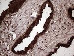 LGALS3 Antibody in Immunohistochemistry (Paraffin) (IHC (P))