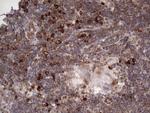 LGALS3 Antibody in Immunohistochemistry (Paraffin) (IHC (P))