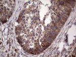 LGALS3 Antibody in Immunohistochemistry (Paraffin) (IHC (P))