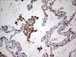 LGALS3 Antibody in Immunohistochemistry (Paraffin) (IHC (P))