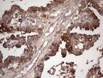 LGALS3 Antibody in Immunohistochemistry (Paraffin) (IHC (P))