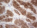 LGALS3 Antibody in Immunohistochemistry (Paraffin) (IHC (P))