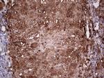 LGALS3 Antibody in Immunohistochemistry (Paraffin) (IHC (P))