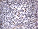 LGALS3 Antibody in Immunohistochemistry (Paraffin) (IHC (P))