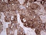 LGALS3 Antibody in Immunohistochemistry (Paraffin) (IHC (P))