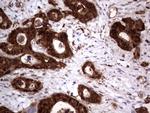 LGALS3 Antibody in Immunohistochemistry (Paraffin) (IHC (P))