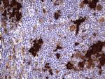 LGALS3 Antibody in Immunohistochemistry (Paraffin) (IHC (P))