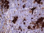 LGALS3 Antibody in Immunohistochemistry (Paraffin) (IHC (P))