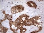 LGALS3 Antibody in Immunohistochemistry (Paraffin) (IHC (P))