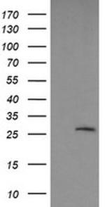 LGALS3 Antibody in Western Blot (WB)