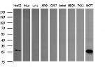 LGALS3 Antibody in Western Blot (WB)