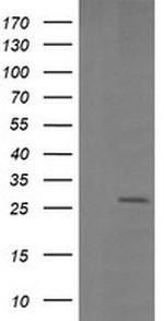 LGALS3 Antibody in Western Blot (WB)