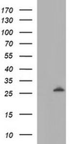 LGALS3 Antibody in Western Blot (WB)