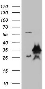 LGALS3 Antibody in Western Blot (WB)