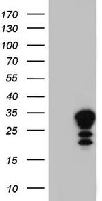 LGALS3 Antibody in Western Blot (WB)