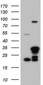 LGALS3 Antibody in Western Blot (WB)