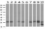 LGALS3 Antibody in Western Blot (WB)