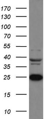 LGALS3 Antibody in Western Blot (WB)
