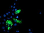 LGALS3BP Antibody in Immunocytochemistry (ICC/IF)