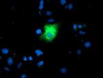 LGALS3BP Antibody in Immunocytochemistry (ICC/IF)