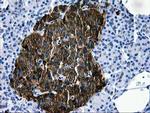 LGALS3BP Antibody in Immunohistochemistry (Paraffin) (IHC (P))