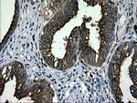 LGALS3BP Antibody in Immunohistochemistry (Paraffin) (IHC (P))