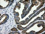 LGALS3BP Antibody in Immunohistochemistry (Paraffin) (IHC (P))