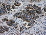 LGALS3BP Antibody in Immunohistochemistry (Paraffin) (IHC (P))