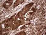 LGALS9 Antibody in Immunohistochemistry (Paraffin) (IHC (P))