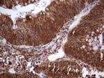 LGALS9 Antibody in Immunohistochemistry (Paraffin) (IHC (P))