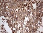 LGALS9 Antibody in Immunohistochemistry (Paraffin) (IHC (P))