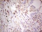 LGALS9 Antibody in Immunohistochemistry (Paraffin) (IHC (P))