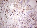 LGALS9 Antibody in Immunohistochemistry (Paraffin) (IHC (P))