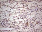 LGALS9 Antibody in Immunohistochemistry (Paraffin) (IHC (P))