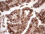 LGALS9 Antibody in Immunohistochemistry (Paraffin) (IHC (P))