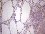 LGALS9 Antibody in Immunohistochemistry (Paraffin) (IHC (P))