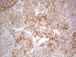 LGALS9 Antibody in Immunohistochemistry (Paraffin) (IHC (P))