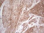 LGALS9 Antibody in Immunohistochemistry (Paraffin) (IHC (P))