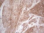 LGALS9 Antibody in Immunohistochemistry (Paraffin) (IHC (P))