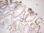 LGALS9 Antibody in Immunohistochemistry (Paraffin) (IHC (P))